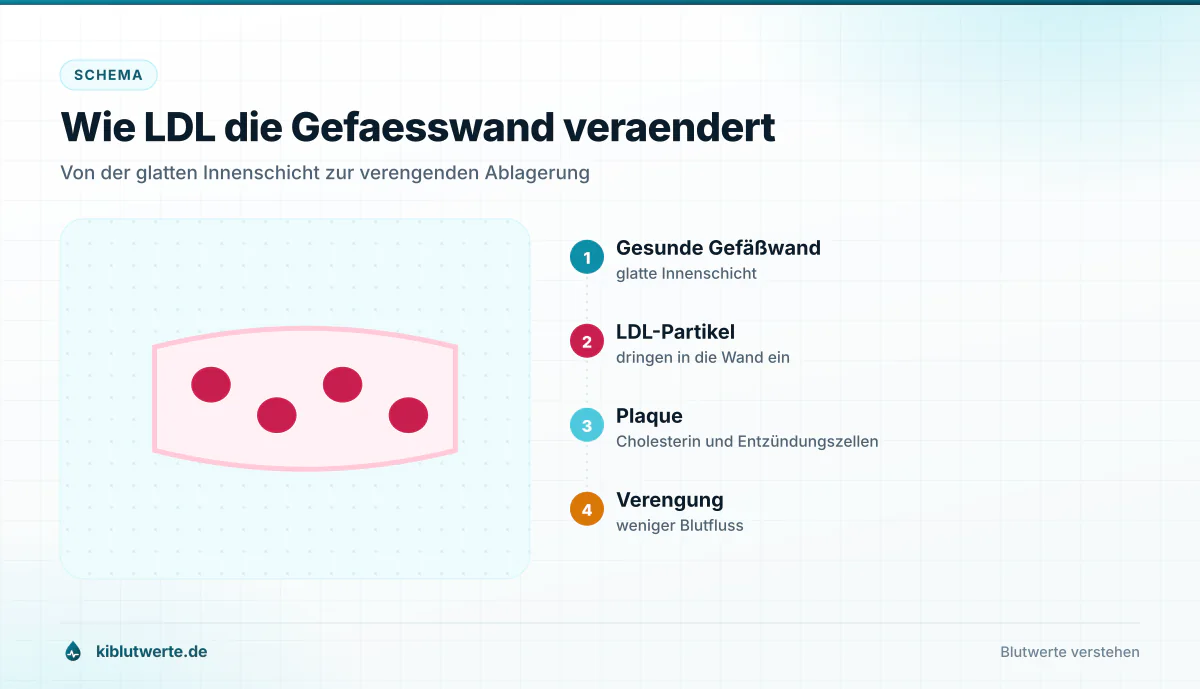 Schematischer Querschnitt eines Blutgefäßes mit eingelagerten LDL-Partikeln, wachsender Plaque und verengtem Gefäßinneren